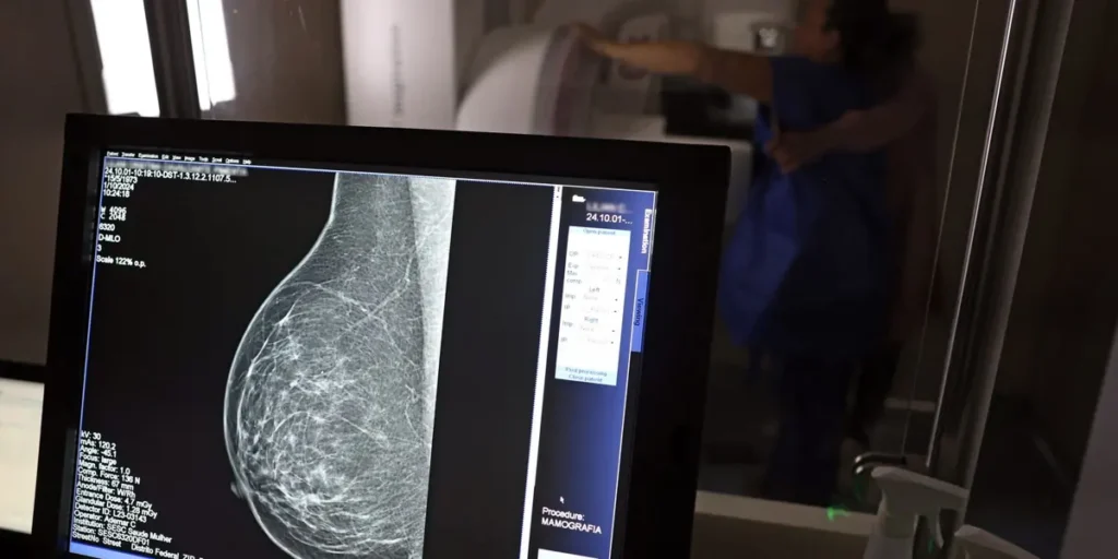 Plano de saúde terá que cobrir mamografia digital para todas as idades — foto da reportagem original