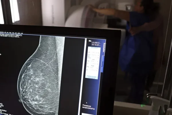 Plano de saúde terá que cobrir mamografia digital para todas as idades — foto da reportagem original